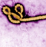 コンゴ民主共和国でエボ​​ラ出血熱が発生。感染者28人のうち15人が死亡